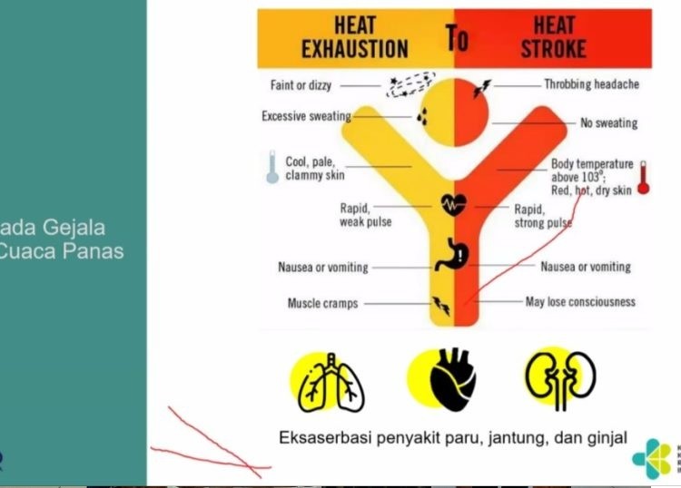 Kenali Tanda Tanda Heat Stroke